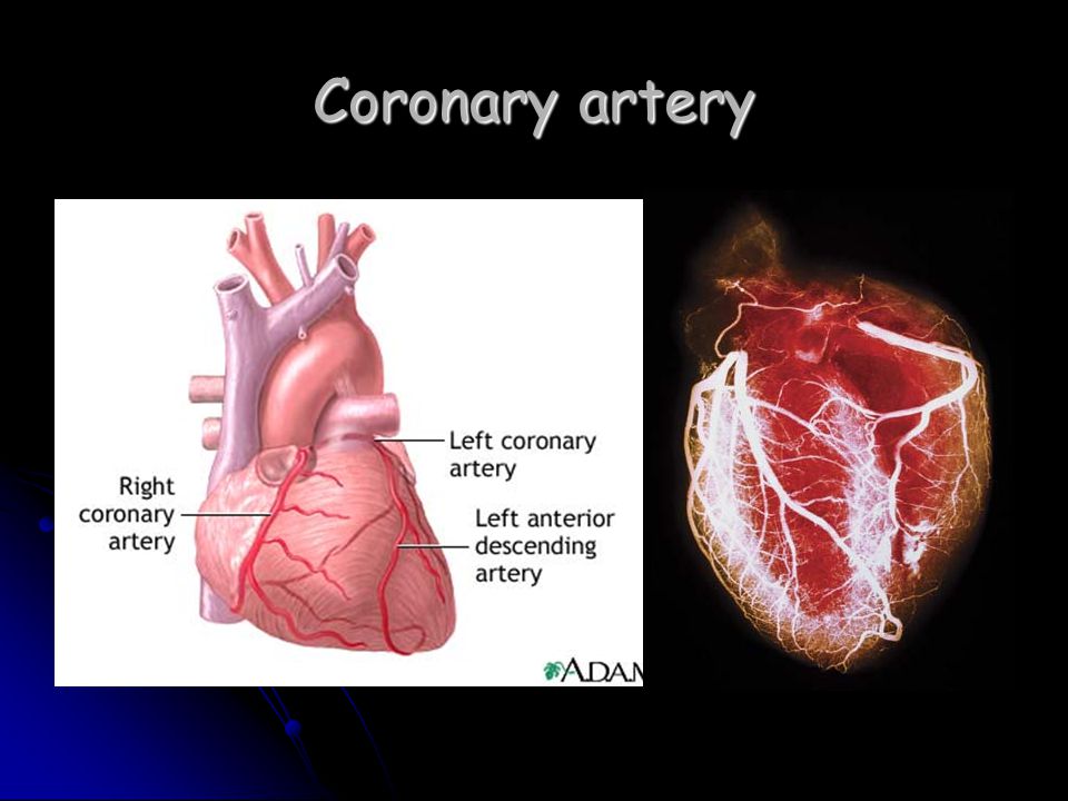 Coronary artery
