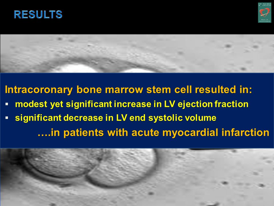 Intracoronary bone marrow stem cell resulted in:  modest yet significant increase in LV ejection fraction  significant decrease in LV end systolic volume ….in patients with acute myocardial infarction ….in patients with acute myocardial infarction
