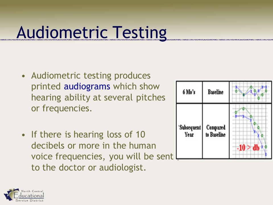 Audiometric Testing Audiometric testing produces printed audiograms which show hearing ability at several pitches or frequencies.