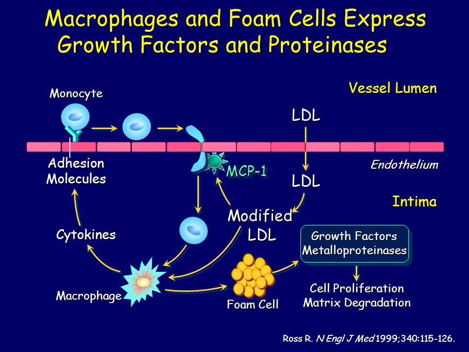 LDL LDL Endothelium Vessel Lumen Monocyte Macrophage Adhesion Molecules Macrophages and Foam Cells Express Growth Factors and Proteinases Macrophages and Foam Cells Express Growth Factors and Proteinases Foam Cell Intima Modified LDL Cytokines Cell Proliferation Matrix Degradation Growth Factors Metalloproteinases Ross R.
