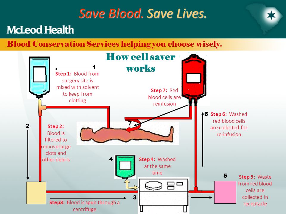 save blood save lives blood conservation services helping you how iv works