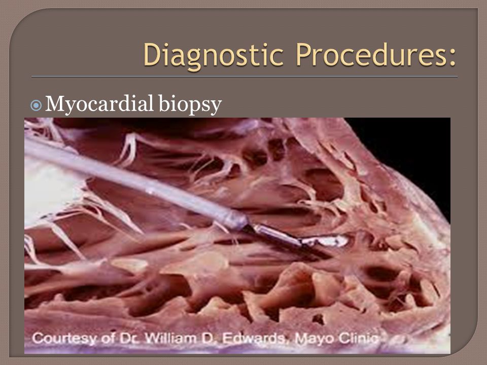  Myocardial biopsy