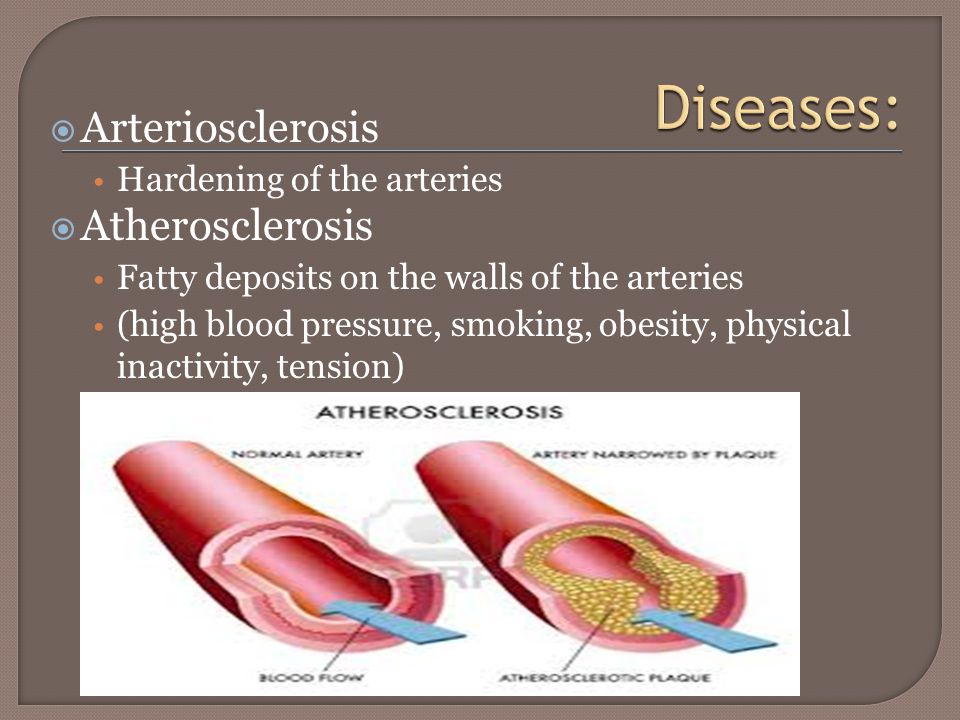  Arteriosclerosis Hardening of the arteries  Atherosclerosis Fatty deposits on the walls of the arteries (high blood pressure, smoking, obesity, physical inactivity, tension)