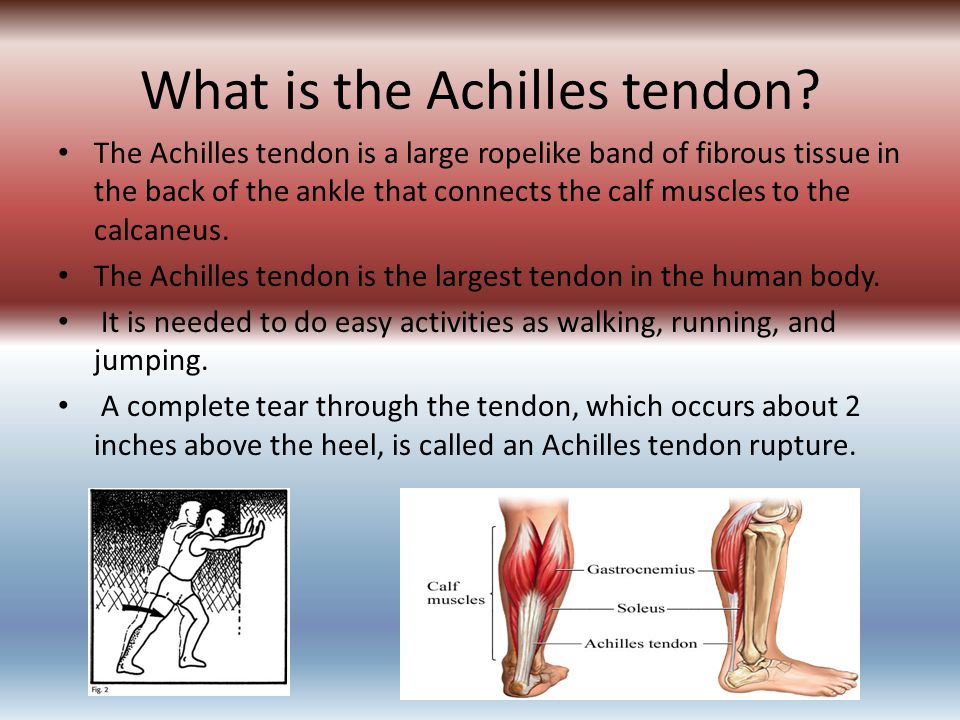 achilles tendon Achilles: achilles, in greek legend, the greatest warrior in the army of agamemnon in the trojan war. achilles tendon Achilles: achilles, in greek legend, the greatest warrior in the army of agamemnon in the trojan war.