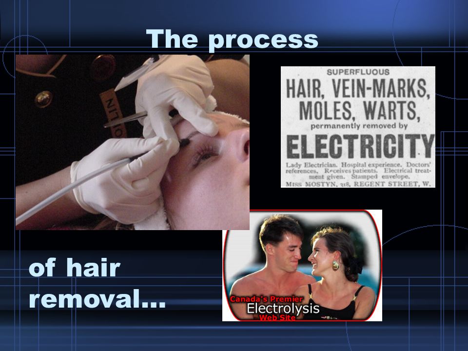 The process of hair removal…