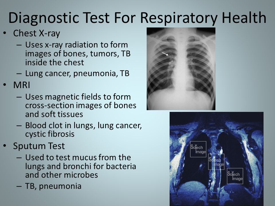 Diagnostic Test For Respiratory Health Chest X-ray – Uses x-ray radiation to form images of bones, tumors, TB inside the chest – Lung cancer, pneumonia, TB MRI – Uses magnetic fields to form cross-section images of bones and soft tissues – Blood clot in lungs, lung cancer, cystic fibrosis Sputum Test – Used to test mucus from the lungs and bronchi for bacteria and other microbes – TB, pneumonia