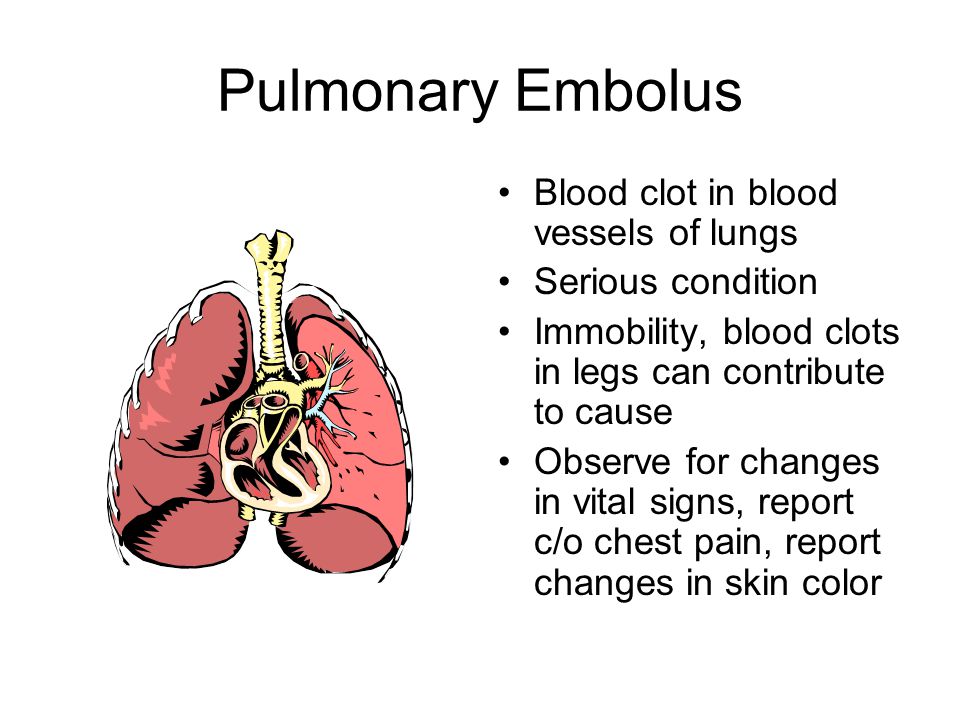 Pulmonary Embolus Blood clot in blood vessels of lungs Serious condition Immobility, blood clots in legs can contribute to cause Observe for changes in vital signs, report c/o chest pain, report changes in skin color