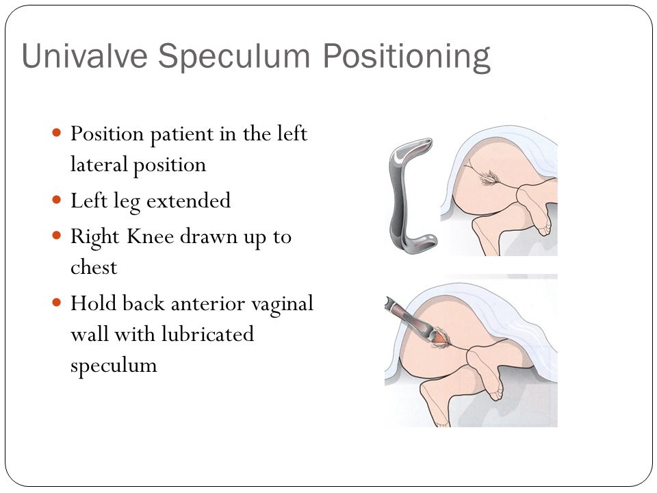 lateral position definition