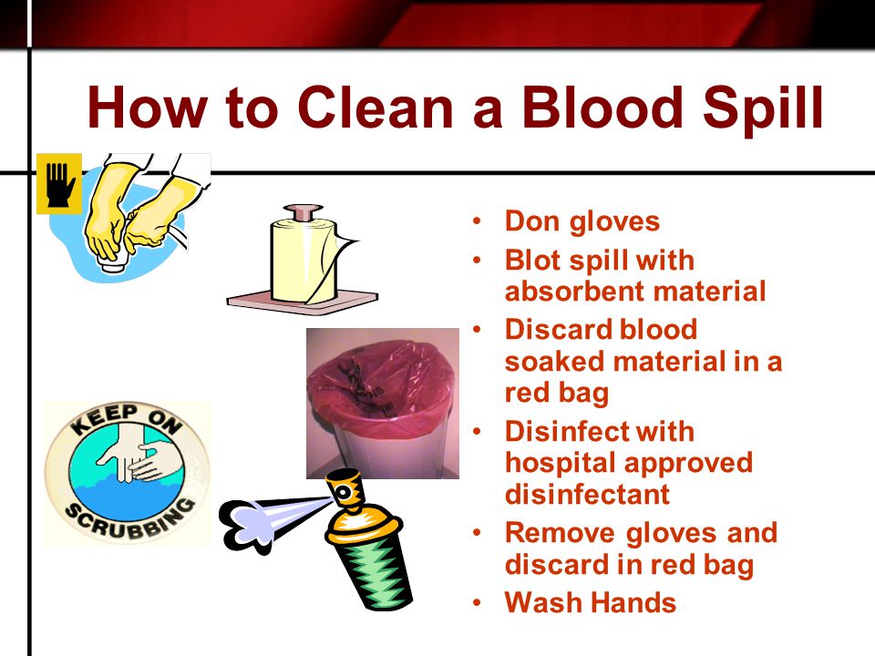 How to Clean a Blood Spill Don gloves Blot spill with absorbent material Discard blood soaked material in a red bag Disinfect with hospital approved disinfectant Remove gloves and discard in red bag Wash Hands