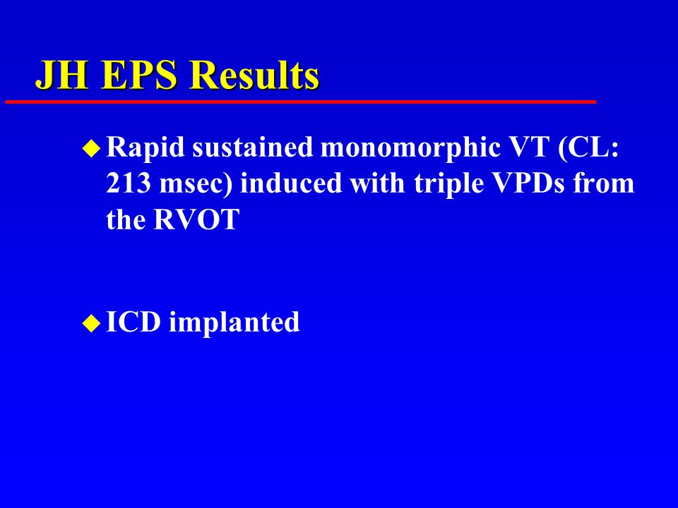JH EPS Results u Rapid sustained monomorphic VT (CL: 213 msec) induced with triple VPDs from the RVOT u ICD implanted