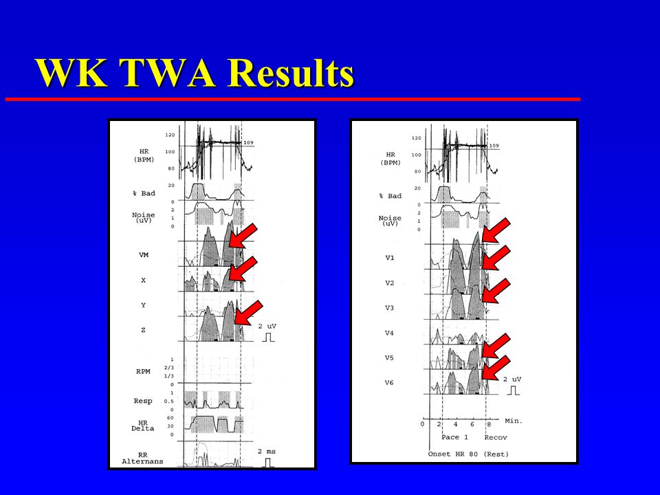 WK TWA Results