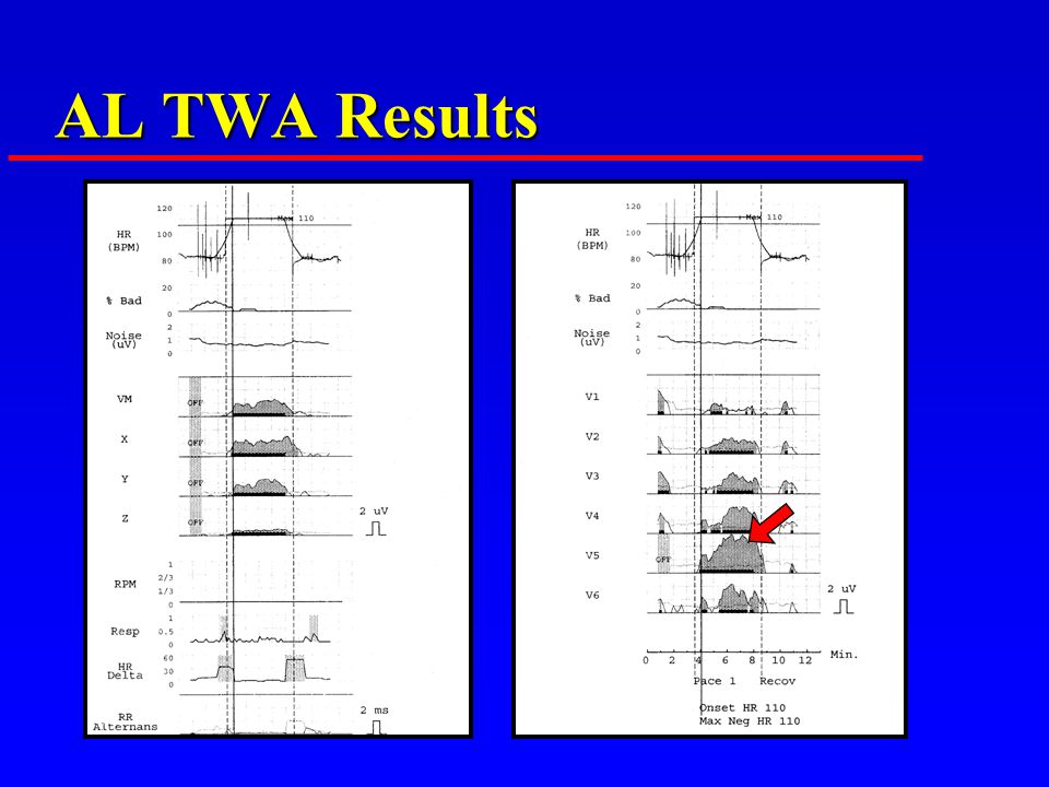 AL TWA Results