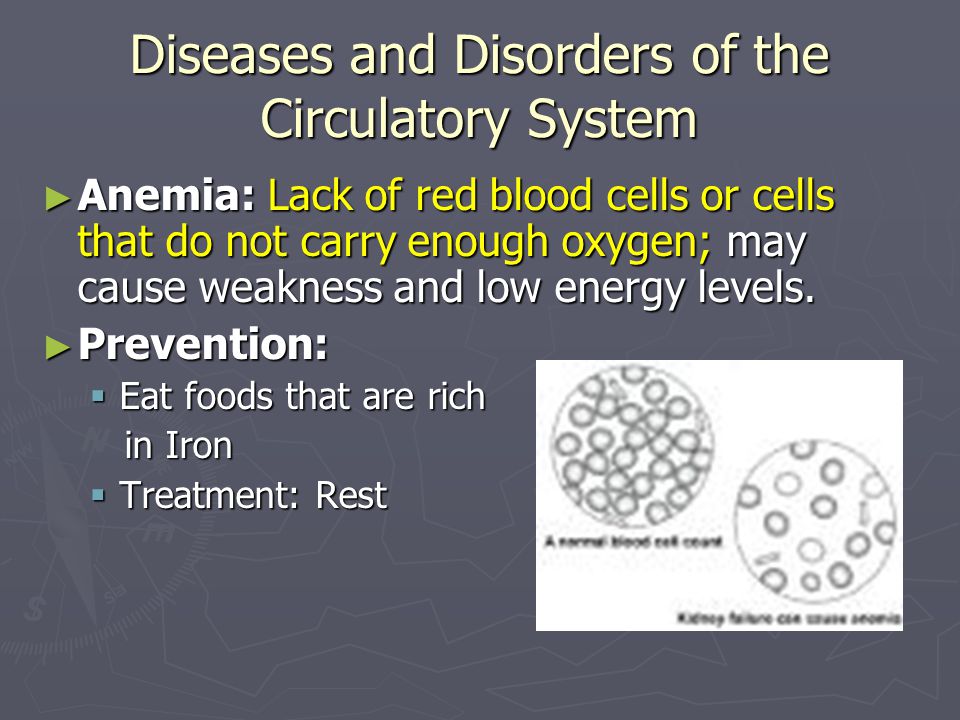 Diseases and Disorders of the Circulatory System ► Anemia: Lack of red blood cells or cells that do not carry enough oxygen; may cause weakness and low energy levels.