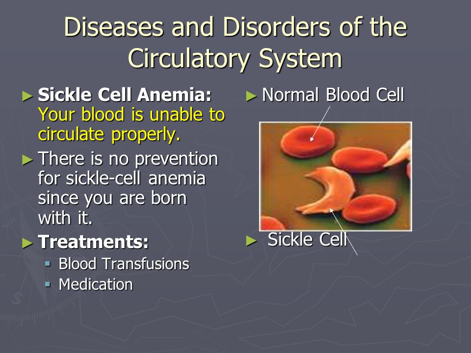 Diseases and Disorders of the Circulatory System ► Sickle Cell Anemia: Your blood is unable to circulate properly.