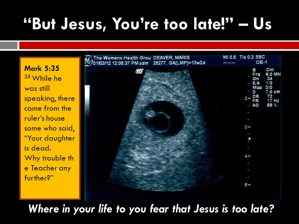 But Jesus, You’re too late! – Us Mark 5:35 35 While he was still speaking, there came from the ruler’s house some who said, Your daughter is dead.