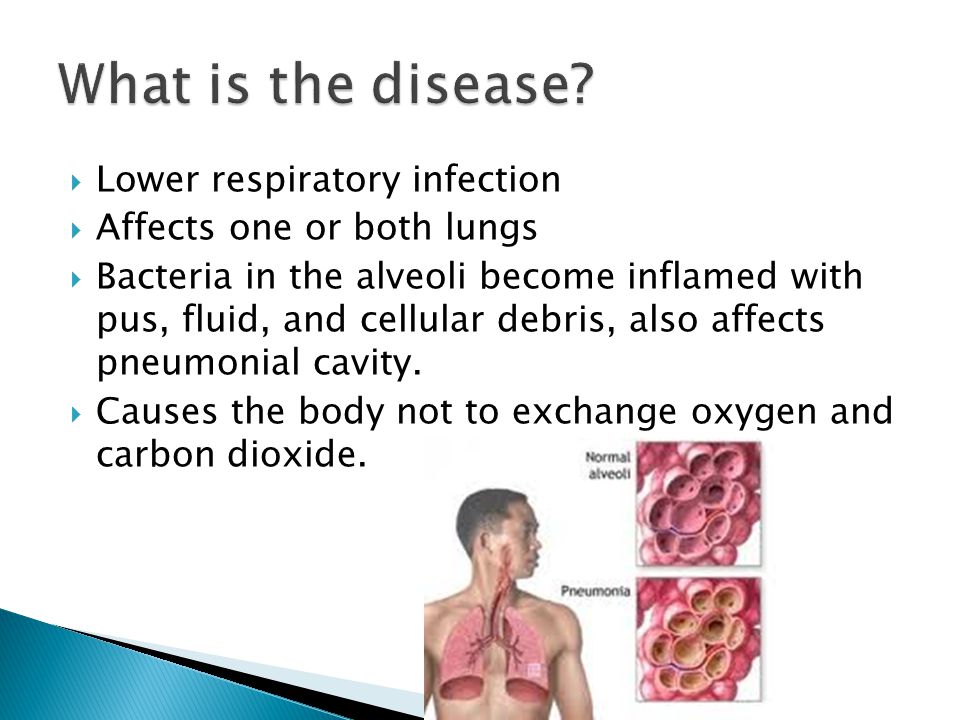  Lower respiratory infection  Affects one or both lungs  Bacteria in the alveoli become inflamed with pus, fluid, and cellular debris, also affects pneumonial cavity.