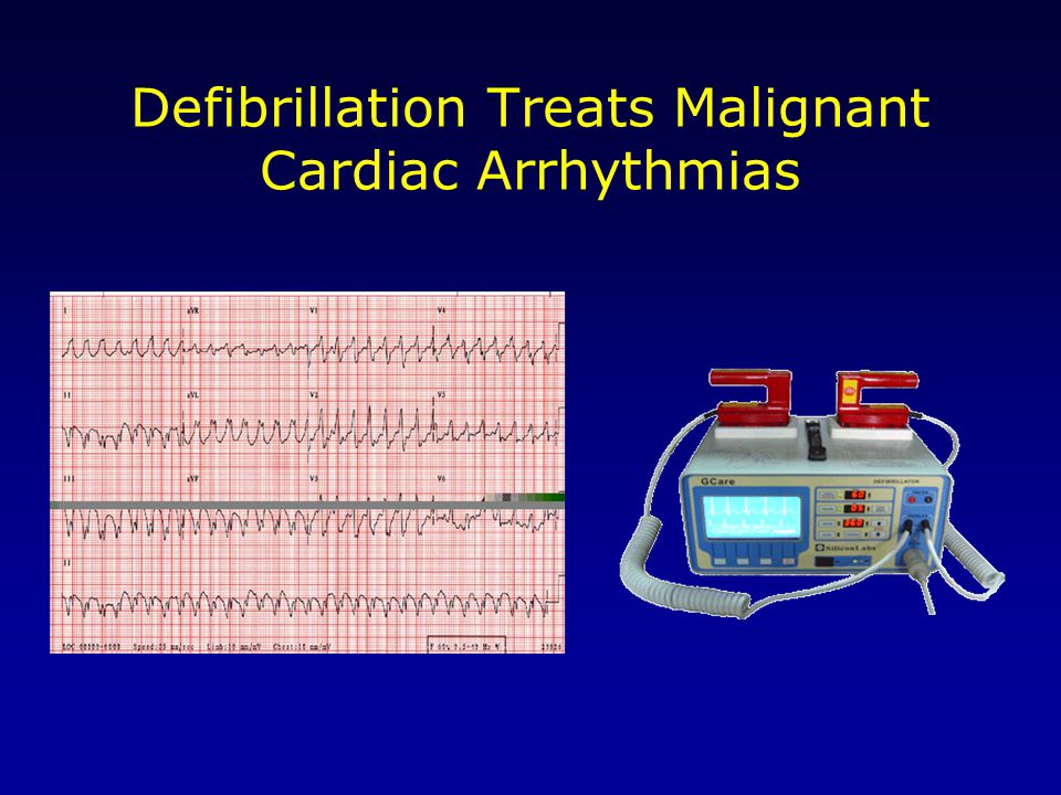 Defibrillation Treats Malignant Cardiac Arrhythmias