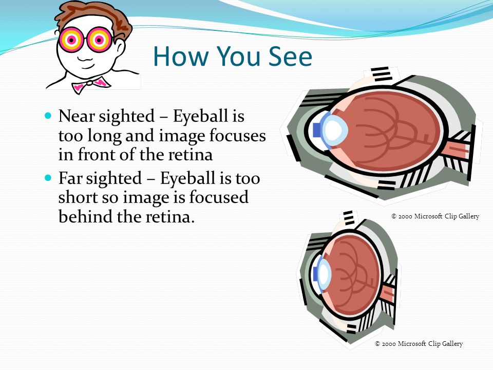Glasses Convex lens correct farsightedness. Farsighted people cannot see objects that are nearby.