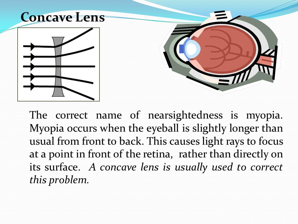 How You See Near sighted – Eyeball is too long and image focuses in front of the retina Far sighted – Eyeball is too short so image is focused behind the retina.