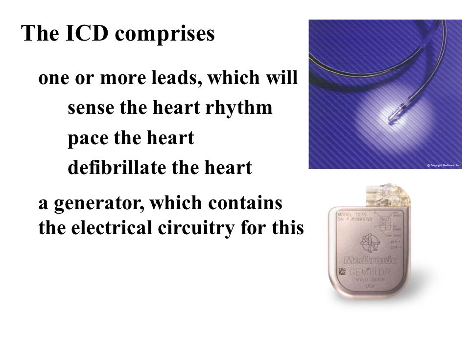 one or more leads, which will sense the heart rhythm pace the heart defibrillate the heart a generator, which contains the electrical circuitry for this The ICD comprises