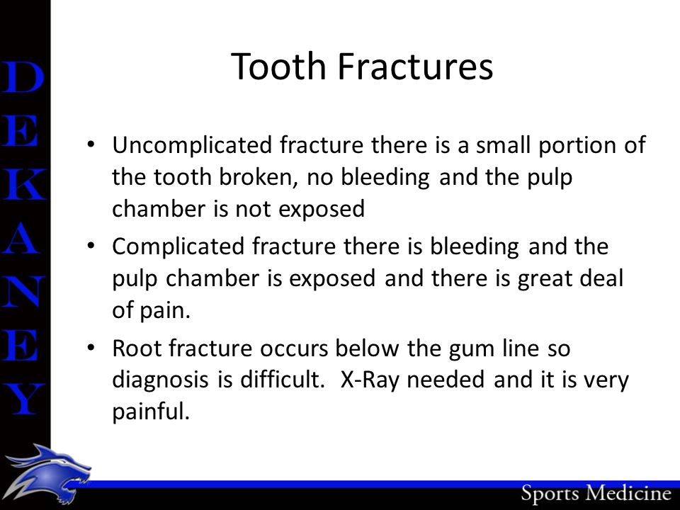 Tooth Fractures Uncomplicated fracture there is a small portion of the tooth broken, no bleeding and the pulp chamber is not exposed Complicated fracture there is bleeding and the pulp chamber is exposed and there is great deal of pain.