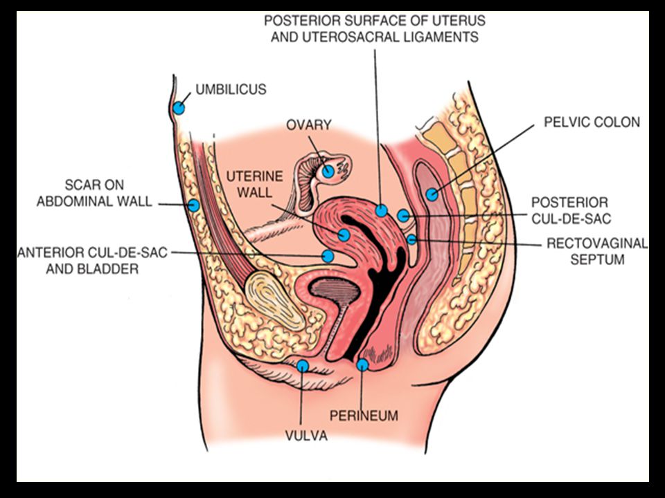Rectovaginal pain with orgasm Bikini contests clearwater