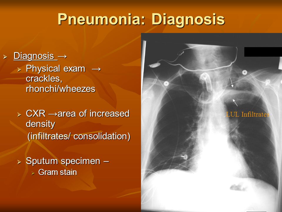 Pneumonia: Diagnosis  Diagnosis →  Physical exam → crackles, rhonchi/wheezes  CXR →area of increased density (infiltrates/ consolidation) (infiltrates/ consolidation)  Sputum specimen –  Gram stain LUL Infiltrates
