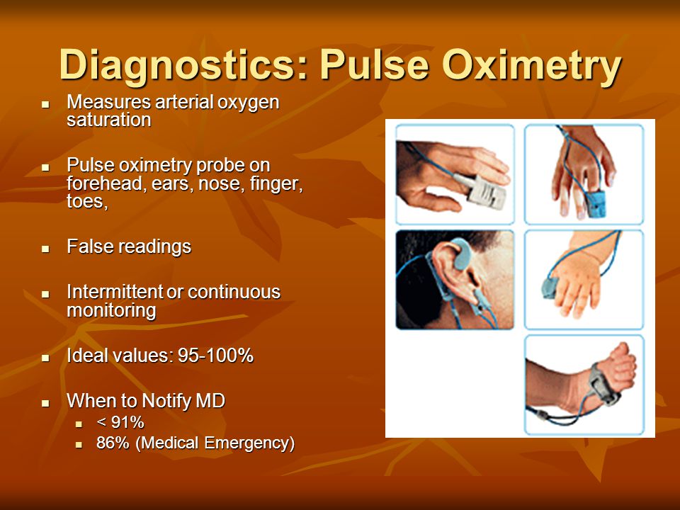 Diagnostics: Pulse Oximetry Measures arterial oxygen saturation Measures arterial oxygen saturation Pulse oximetry probe on forehead, ears, nose, finger, toes, Pulse oximetry probe on forehead, ears, nose, finger, toes, False readings False readings Intermittent or continuous monitoring Intermittent or continuous monitoring Ideal values: % Ideal values: % When to Notify MD When to Notify MD < 91% < 91% 86% (Medical Emergency) 86% (Medical Emergency)