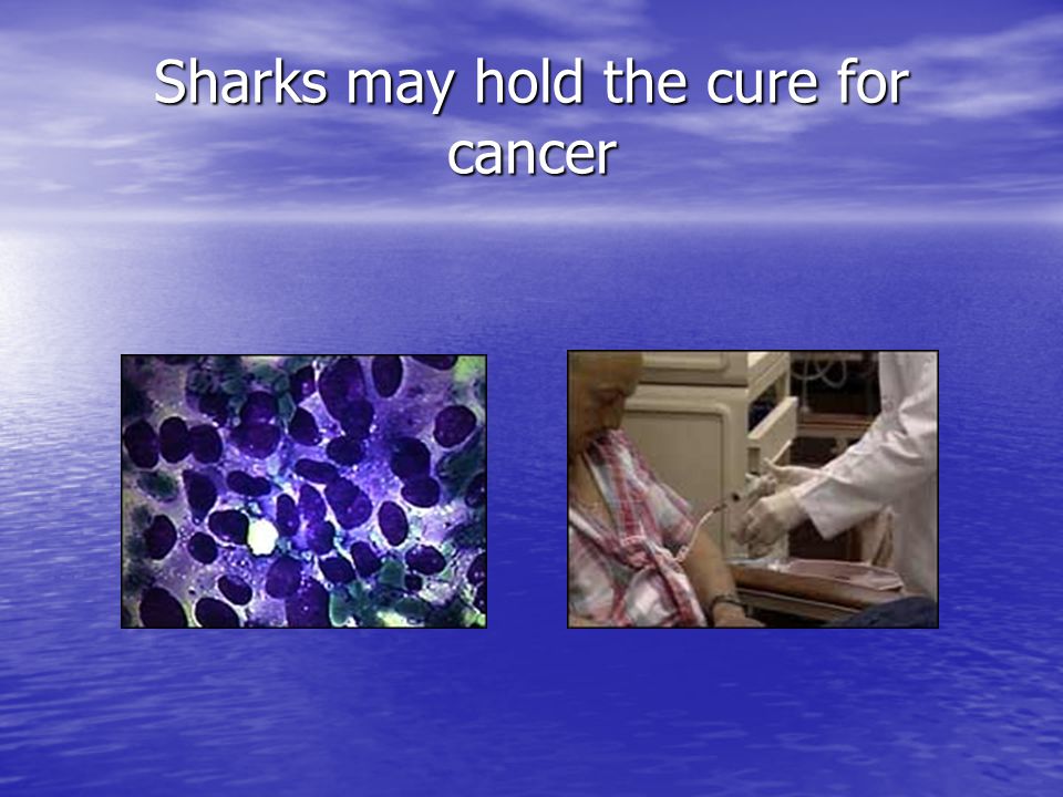 Sharks may hold the cure for cancer