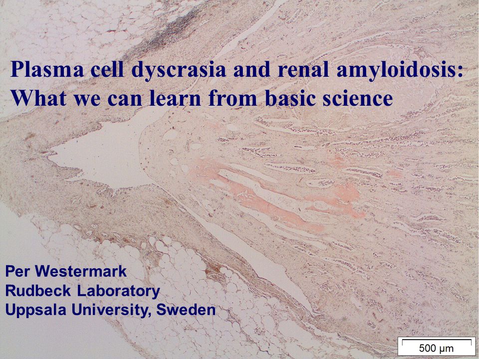 Plasma cell dyscrasia and renal amyloidosis: What we can learn from basic science Per Westermark Rudbeck Laboratory Uppsala University, Sweden