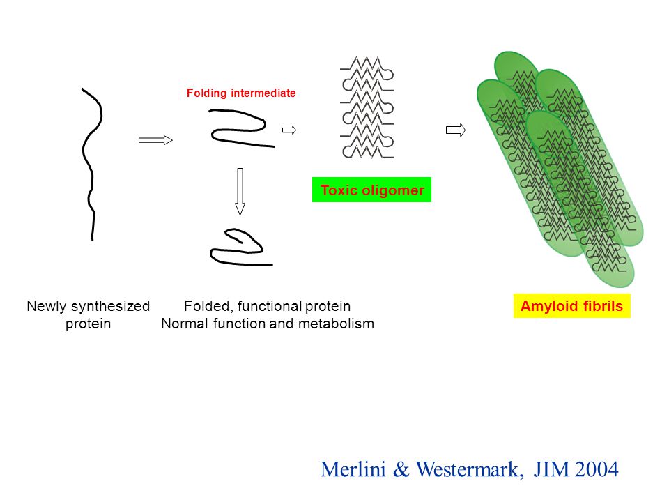 Folded, functional protein Normal function and metabolism Newly synthesized protein Folding intermediate Toxic oligomer Amyloid fibrils Merlini & Westermark, JIM 2004