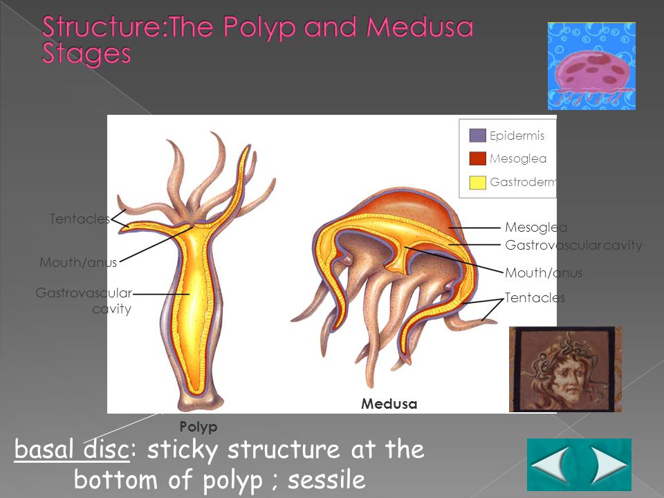 basal disc: sticky structure at the bottom of polyp ; sessile Epidermis Mesoglea Gastroderm Mesoglea Gastrovascular cavity Mouth/anus Tentacles Mouth/anus Gastrovascular cavity Polyp Medusa