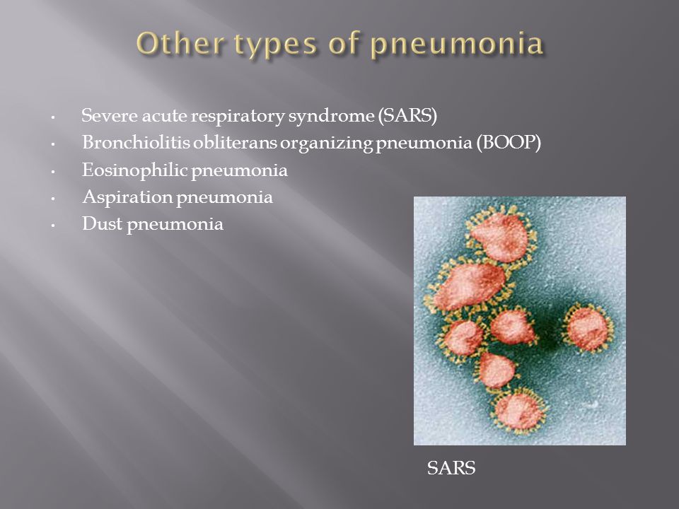 Severe acute respiratory syndrome (SARS) Bronchiolitis obliterans organizing pneumonia (BOOP) Eosinophilic pneumonia Aspiration pneumonia Dust pneumonia SARS