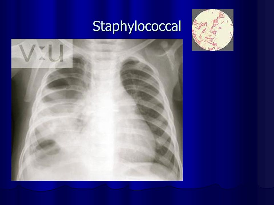 Staphylococcal
