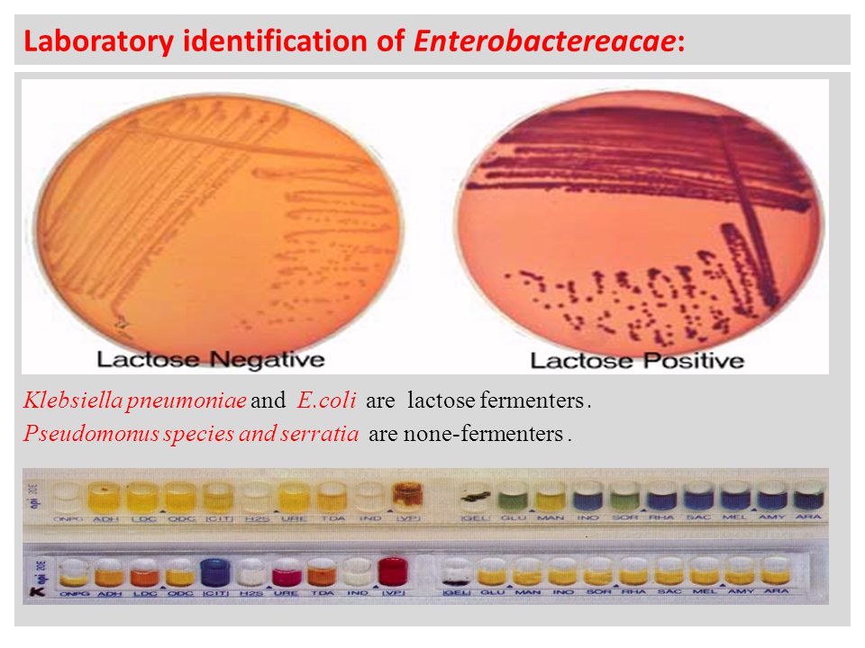 Laboratory identification of Enterobactereacae: Klebsiella pneumoniae and E.coli are lactose fermenters.