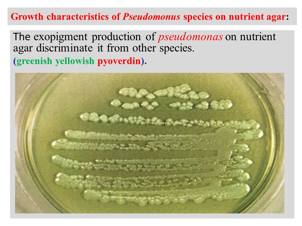 Growth characteristics of Pseudomonus species on nutrient agar: The exopigment production of pseudomonas on nutrient agar discriminate it from other species.
