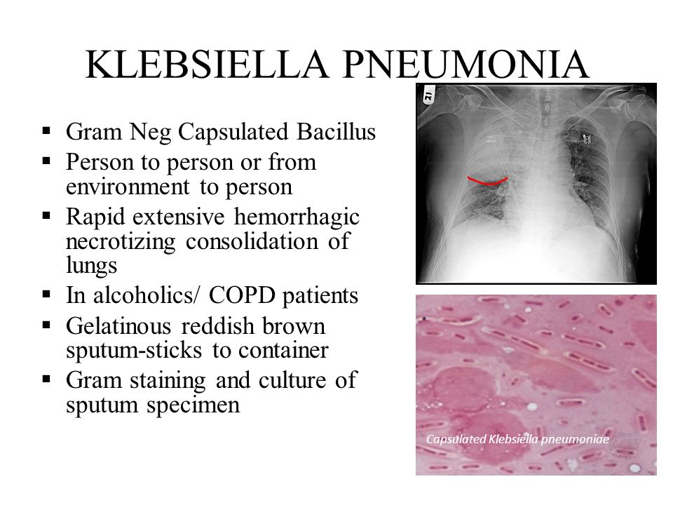 gram stain pos neg nag short essay Interpretive essay thesis statement, essay ap language synthesis essay 2011 hyundai short essay about fake friends meme bell media review essay write an. gram stain pos neg nag short essay Interpretive essay thesis statement, essay ap language synthesis essay 2011 hyundai short essay about fake friends meme bell media review essay write an.