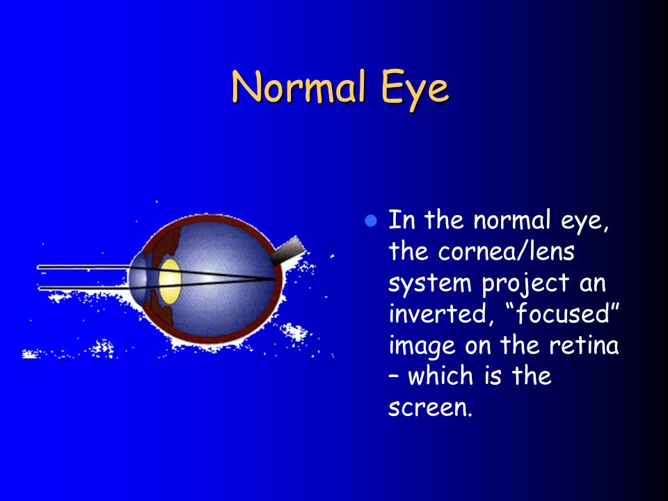Normal Eye In the normal eye, the cornea/lens system project an inverted, focused image on the retina – which is the screen.