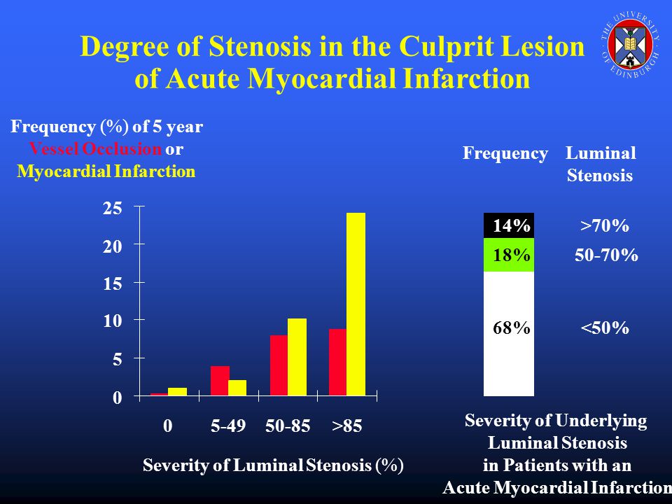 >85 Severity of Luminal Stenosis (%) Frequency (%) of 5 year Vessel Occlusion or Myocardial Infarction <50% 50-70% >70% 68% 18% 14% Severity of Underlying Luminal Stenosis in Patients with an Acute Myocardial Infarction Luminal Stenosis Frequency Degree of Stenosis in the Culprit Lesion of Acute Myocardial Infarction