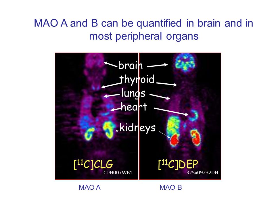 brain thyroid lungs heart kidneys [ 11 C]CLG[ 11 C]DEP CDH007WB1325x09232DH MAO A and B can be quantified in brain and in most peripheral organs MAO A MAO B