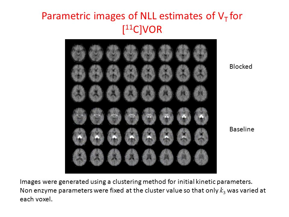 Blocked Baseline Parametric images of NLL estimates of V T for [ 11 C]VOR Images were generated using a clustering method for initial kinetic parameters.