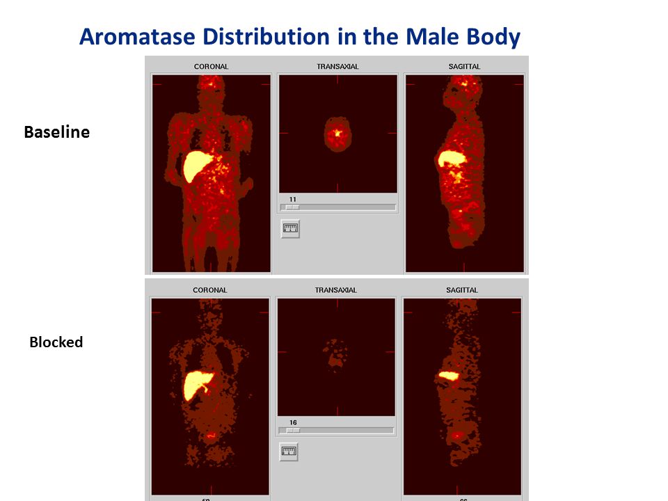 Baseline Blocked Aromatase Distribution in the Male Body