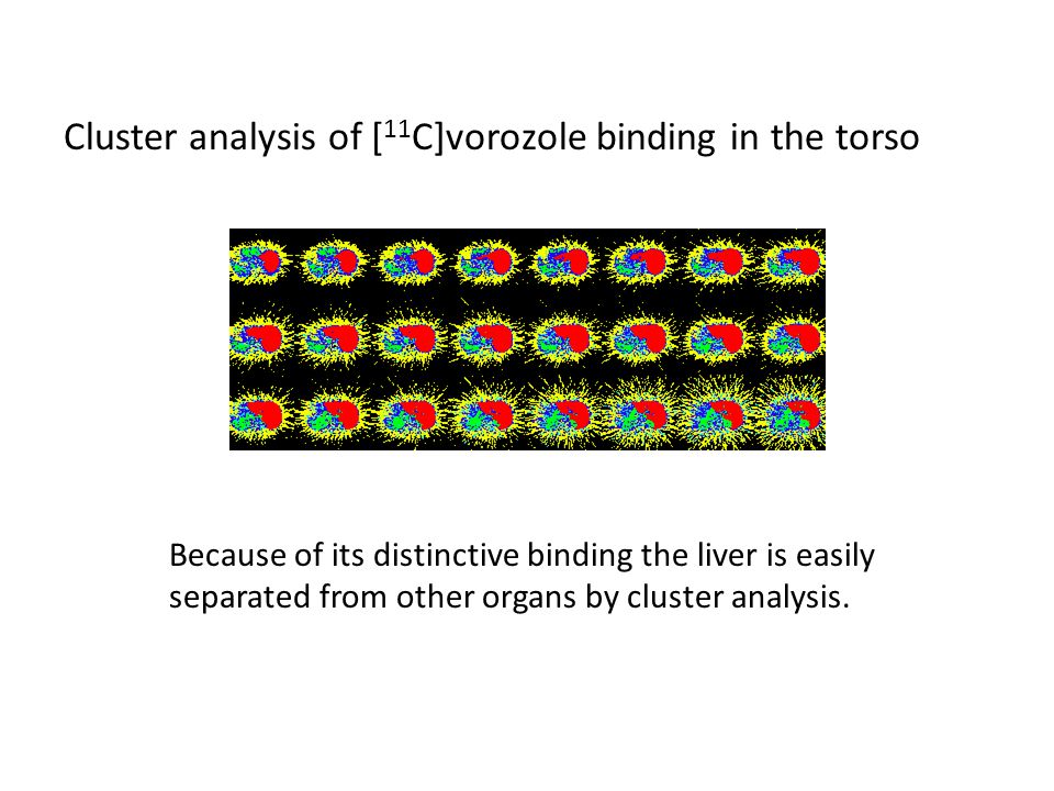 Cluster analysis of [ 11 C]vorozole binding in the torso Because of its distinctive binding the liver is easily separated from other organs by cluster analysis.