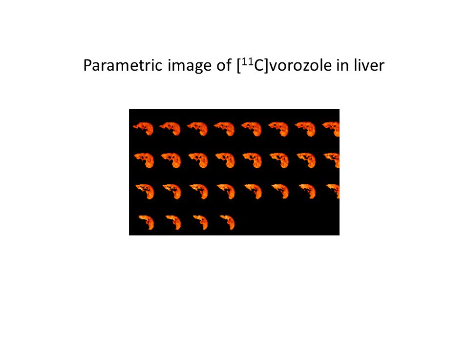 Parametric image of [ 11 C]vorozole in liver