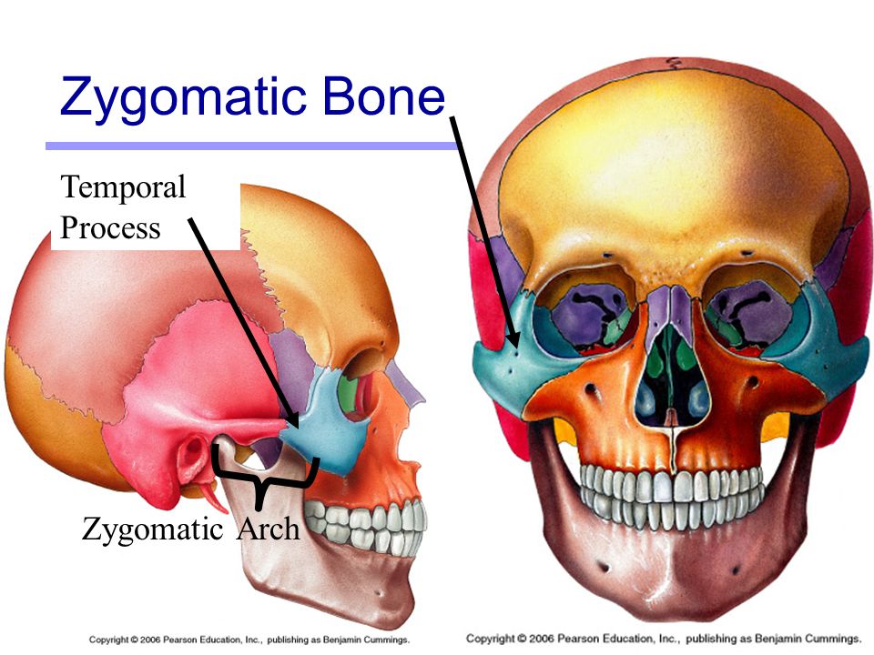 What is the common name for the zygomatic bone?