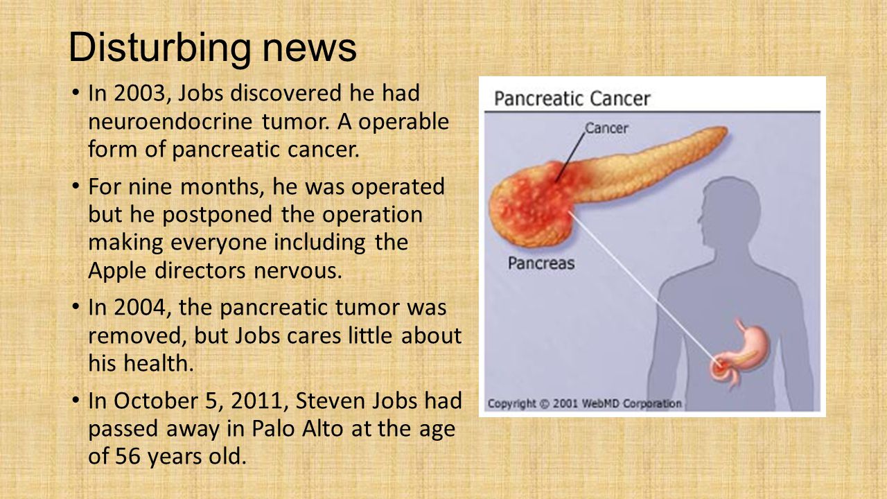 Disturbing news In 2003, Jobs discovered he had neuroendocrine tumor.