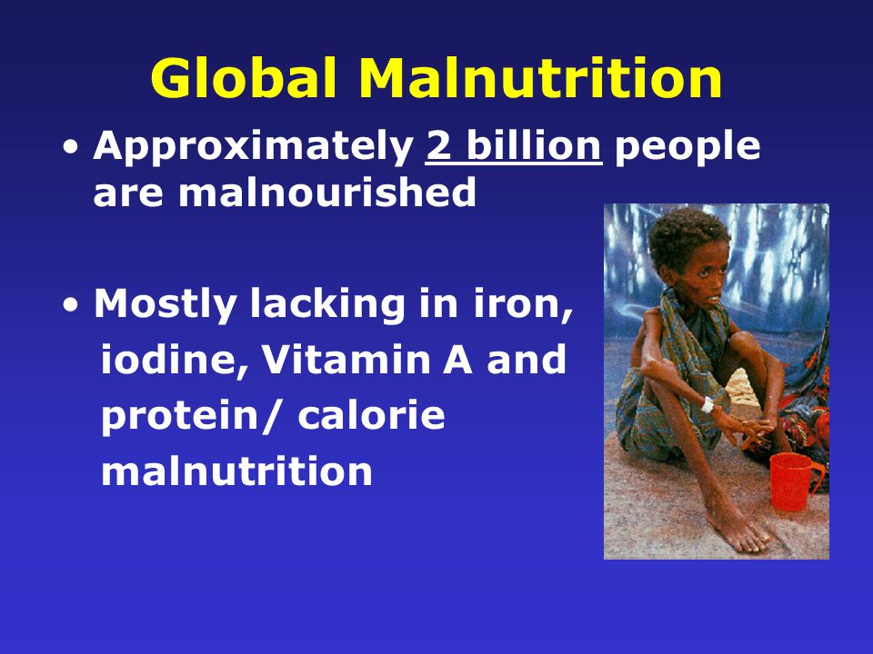 Worldwide Food Shortages Famine: Extreme food shortage in an area that causes widespread starvation and death.