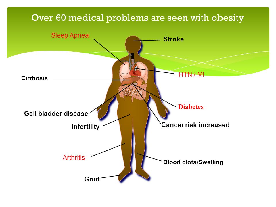 Over 60 medical problems are seen with obesity Sleep Apnea Cirrhosis HTN / MI Infertility Arthritis Gall bladder disease Cancer risk increased Blood clots/Swelling Gout Stroke Diabetes
