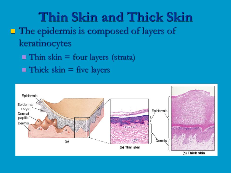 The epidermis is composed of layers of keratinocytes The epidermis is composed of layers of keratinocytes Thin skin = four layers (strata) Thin skin = four layers (strata) Thick skin = five layers Thick skin = five layers Thin Skin and Thick Skin