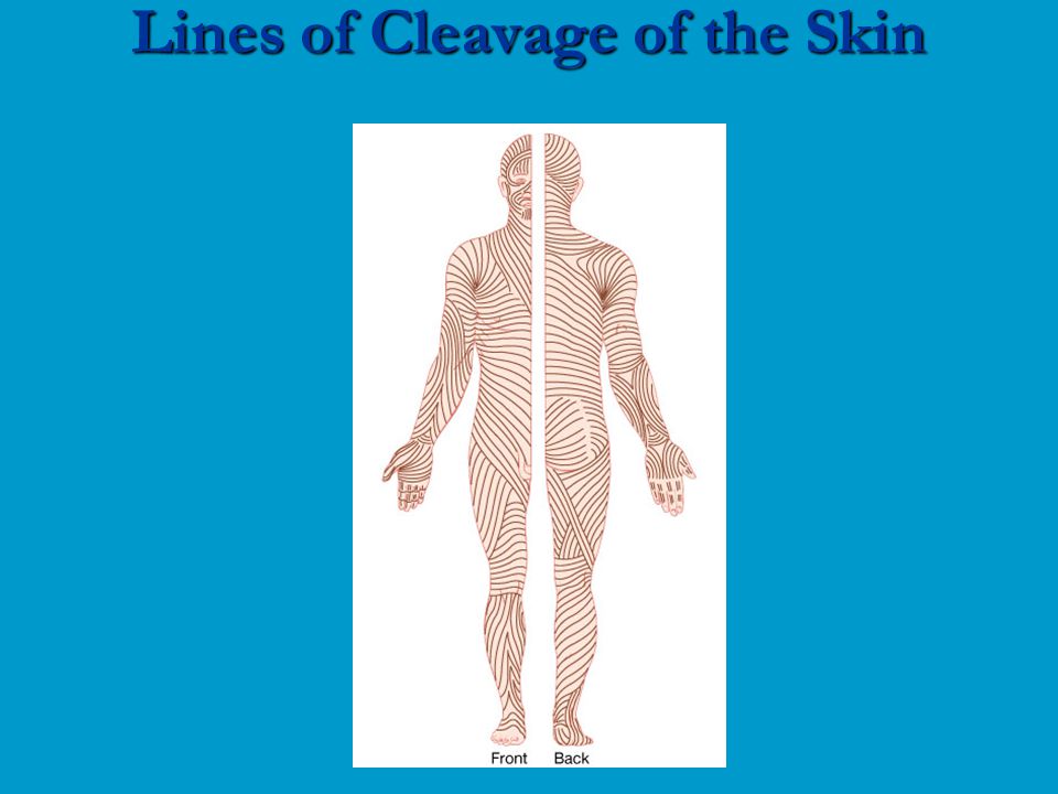 Lines of Cleavage of the Skin